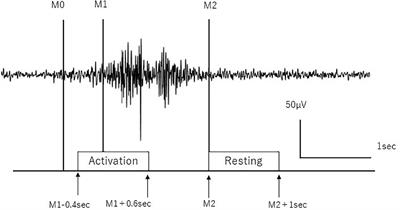 Event-Related Desynchronization and Corticomuscular Coherence Observed During Volitional Swallow by Electroencephalography Recordings in Humans